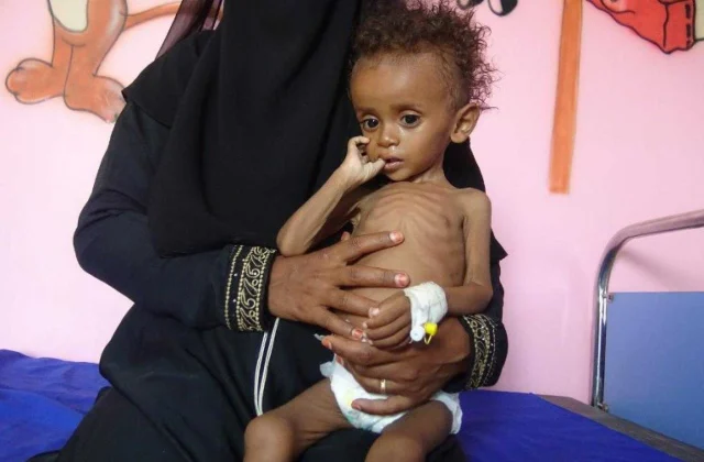 In ka badan 20 milyan oo ruux oo Cunno la’aan ku heysata Yemen!
