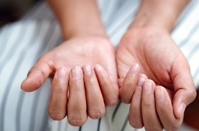 6 Indicators of an Iron Deficiency You Ought to By no means Ignore