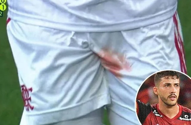 Xiniinyaha Ayuu Ka Dhaawacmay, Inuu Ciyaarta Sii Wato Ayuu