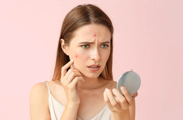 6 Worst-Ever Meals for Your Pores and skin
