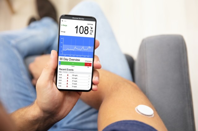 continuous glucose monitoring