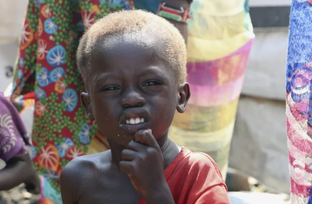 Greater than 1 million teenagers in southern Sudan are vulnerable to demise from serious acute malnutrition