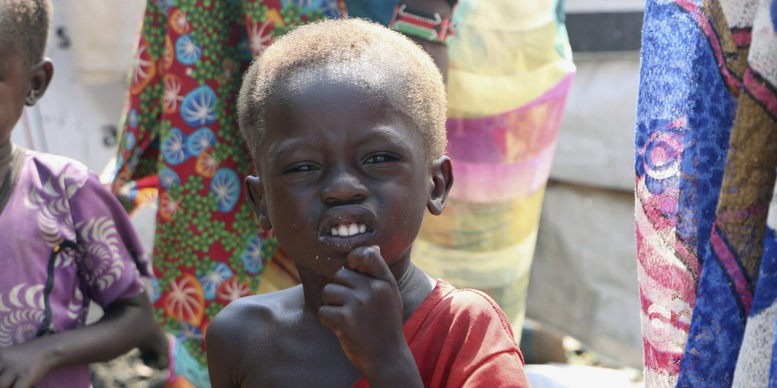 More than 1 million children in southern Sudan are at risk of dying from severe acute malnutrition
