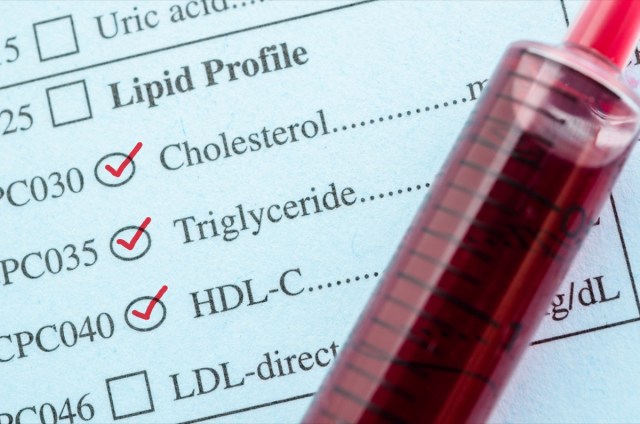 red mark check on cholesterol, triglyceride and hdl-con request form with blood sample in blood tube for test