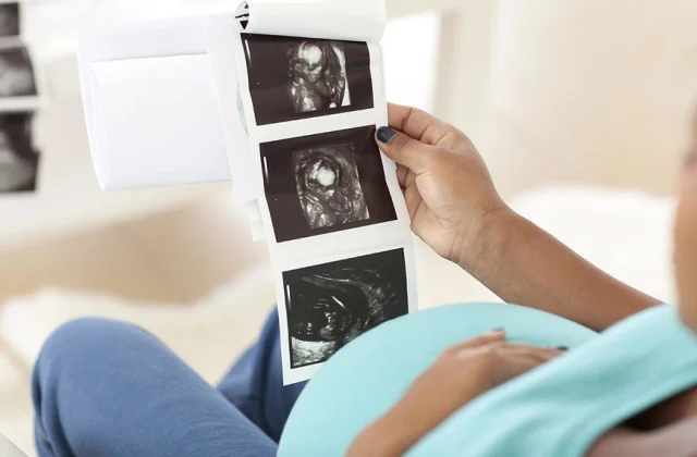 The case of a girl who’s pregnant with septum spots units