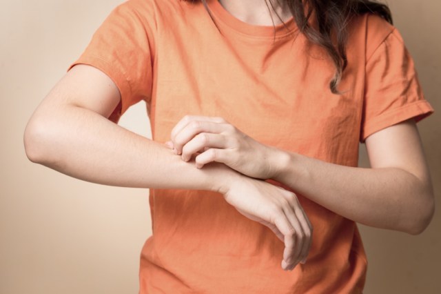 women scratch itchy arm with hand.