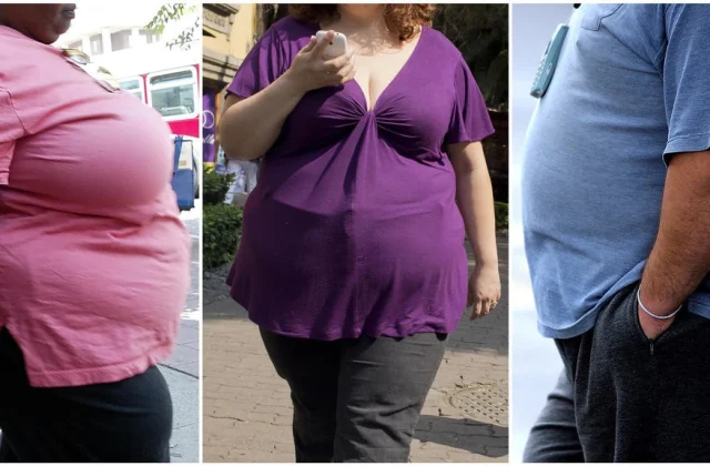 How do you do obesity?
