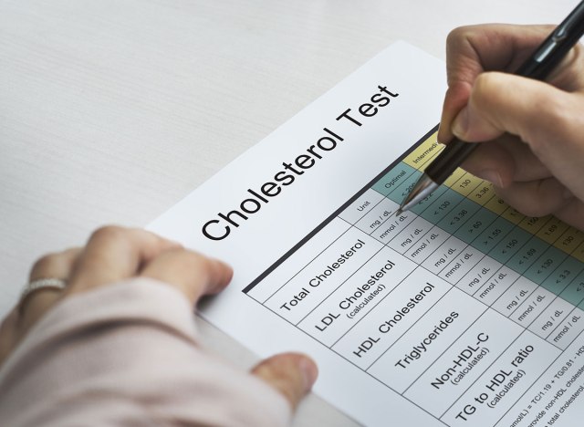 cholesterol test