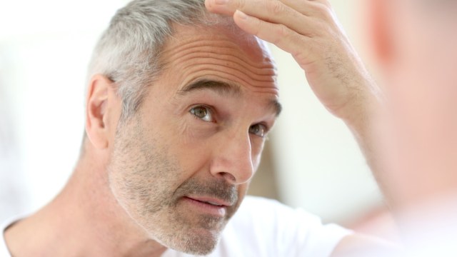 senior man and hair loss issue