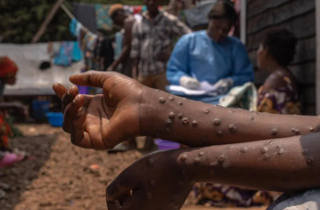 DR Congo receives its first batch of nearly 100,000 doses of