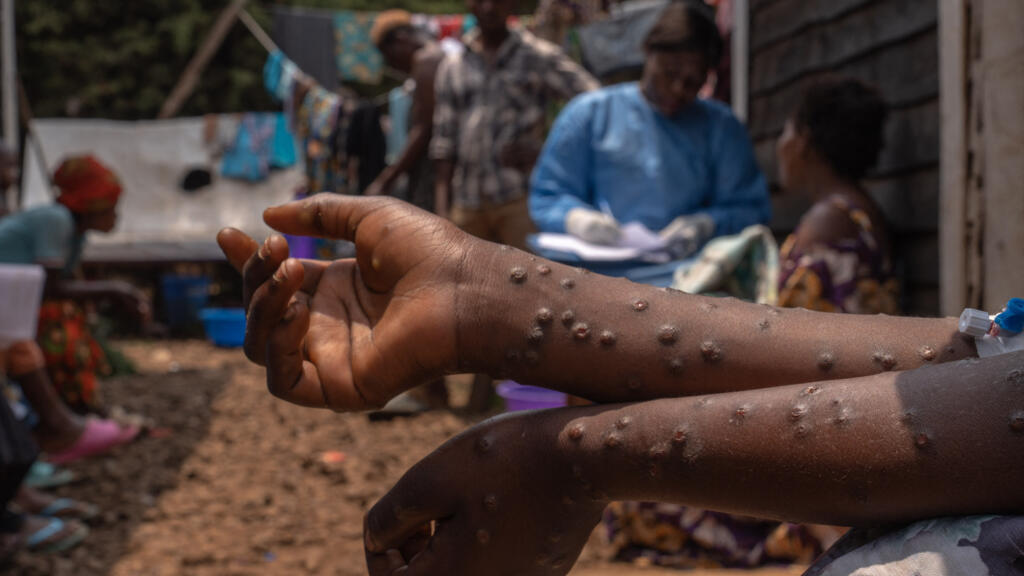 DR Congo receives its first batch of nearly 100000 doses