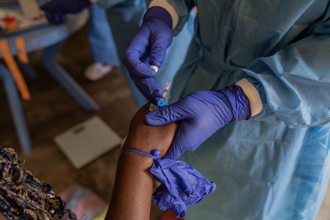 Clinical trial to develop mpox vaccine set to begin in Kenya