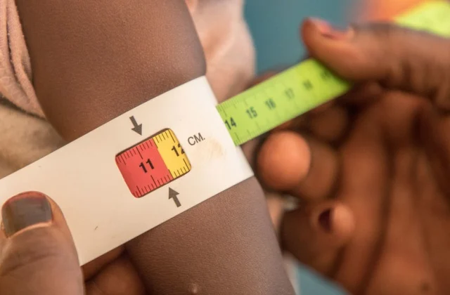 Nigerian Government Sounds Alarm on ‘Triple Challenge’ of Malnutrition