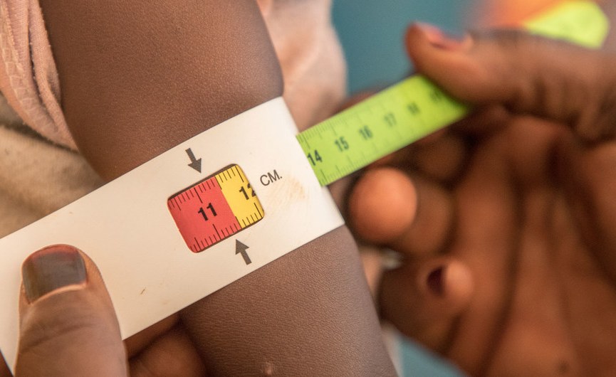 Nigerian Govt Raises Alarm Over 'Triple Burden' of Malnutrition