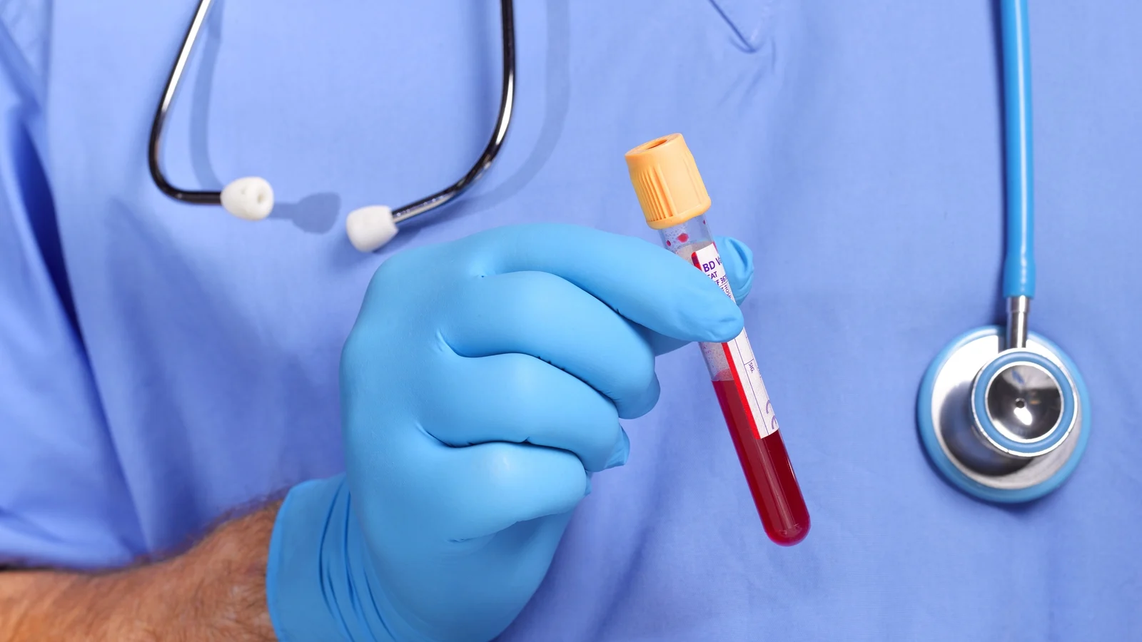 Blood test for more than 50 cancers delivers 'exciting' results