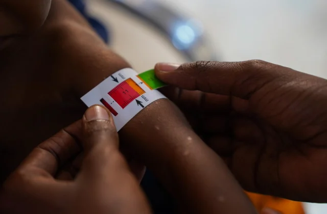 The Tragic Toll of Malnutrition in Kebbi State, Nigeria