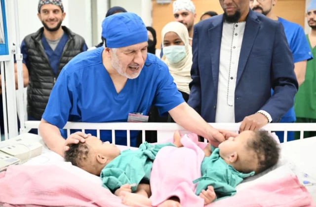 Saudi surgeons successfully separate conjoined Somali twins after 14-hour operation