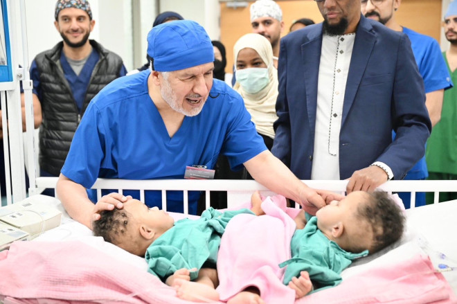 Saudi surgeons successfully separate conjoined Somali twins in 14-hour operation