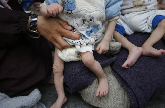 UN says about 4.9 million children under five died in 2024