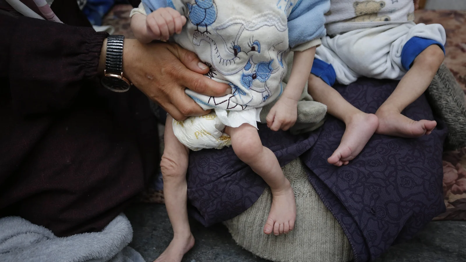 UN says about 4.9 million children under five died in 2024