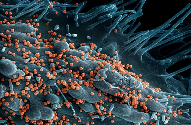 Nigeria Reports Lassa Fever Death Toll Reaches 191