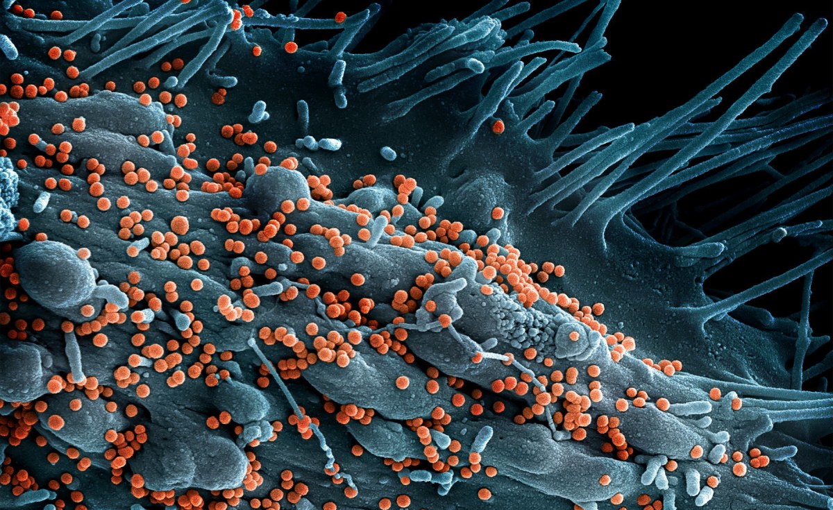 Nigeria Reports Lassa Fever Death Toll Reaches 191