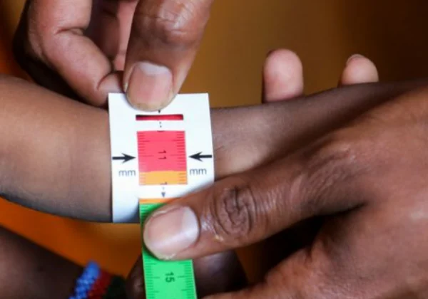 Somalia’s child hunger crisis worsens as aid cuts force facilities to close, UNICEF says